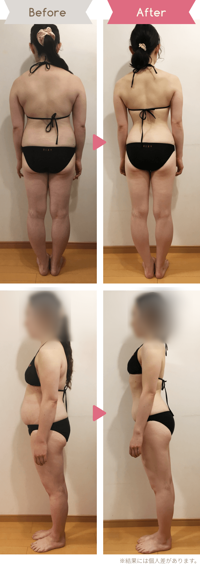 30代女性|6か月、−15kgのBefore/After