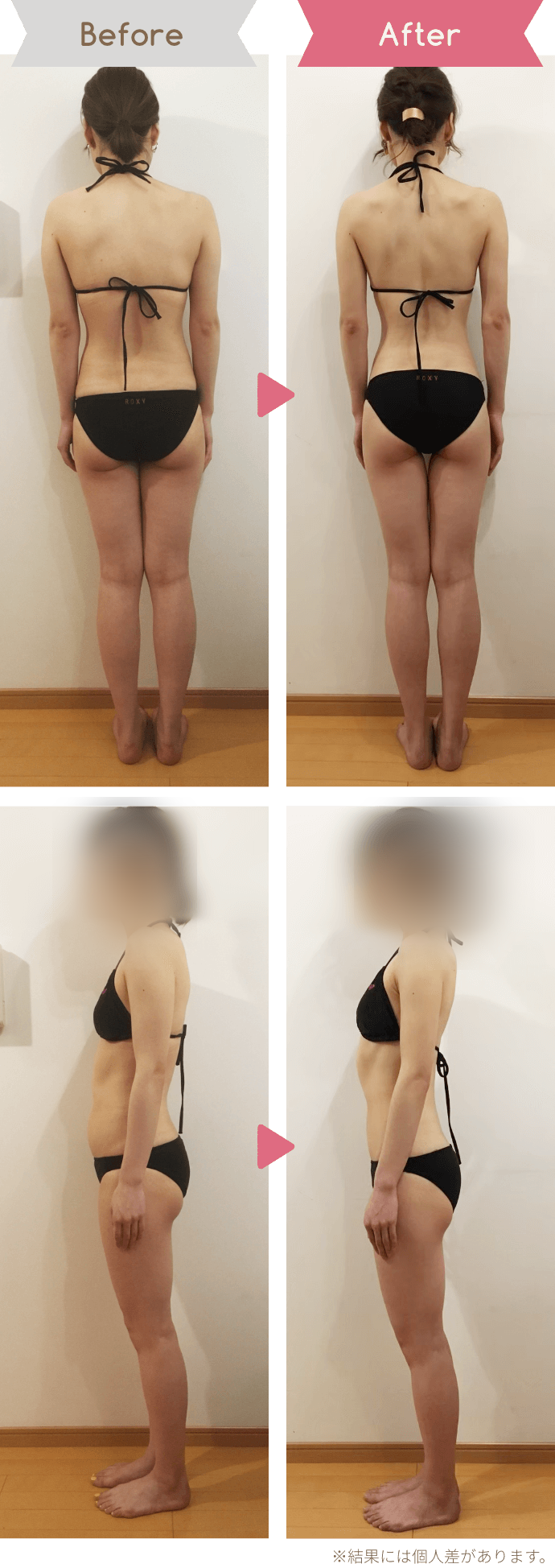 30代女性|6か月、−5kgのBefore/After