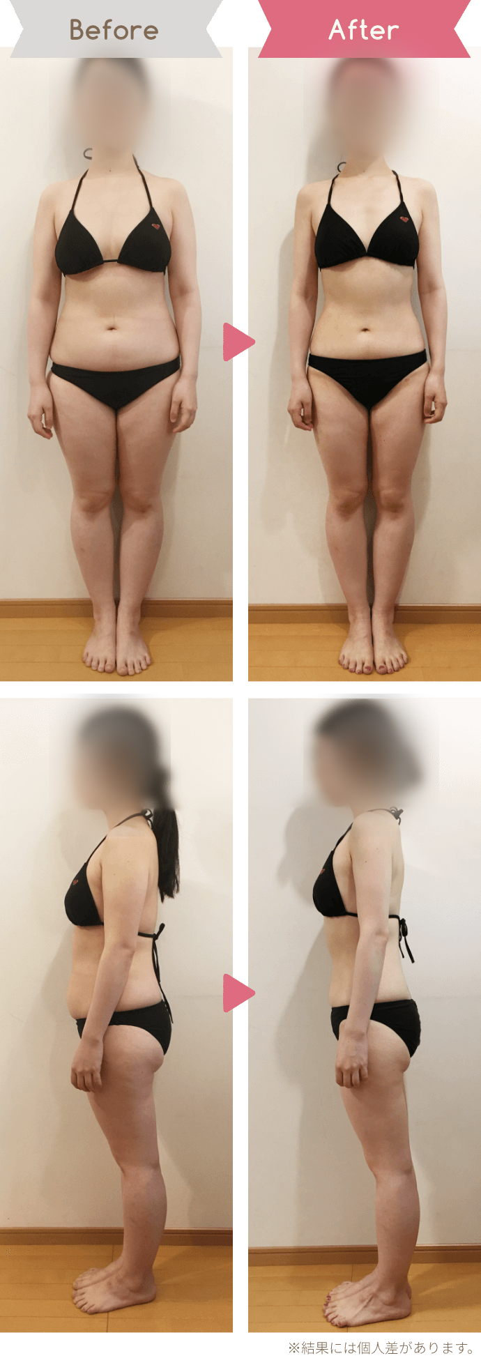 20代女性|6か月、−8kgのBefore/After