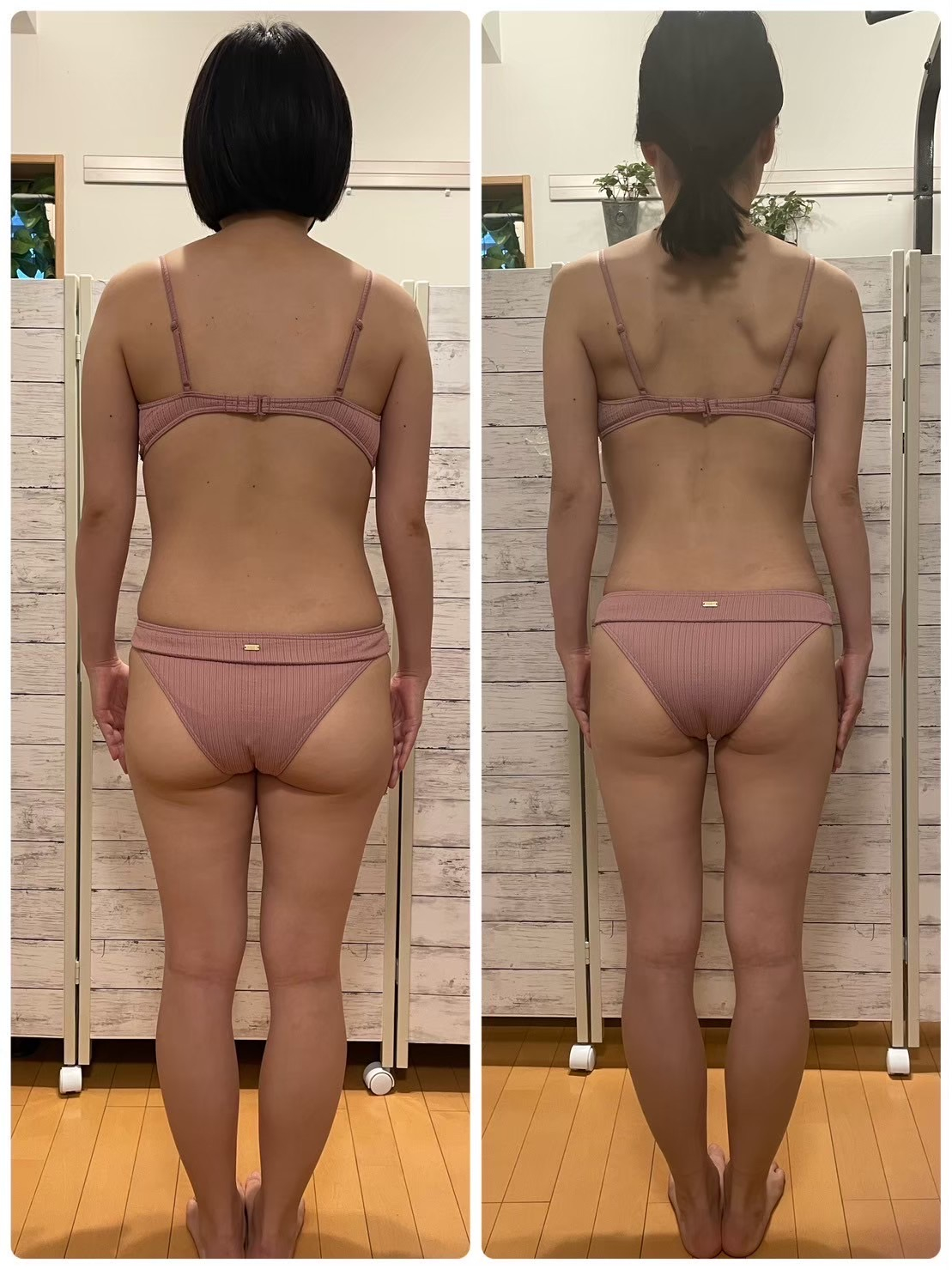 30代女性|6か月、−10kgの後ろ姿Before/After
