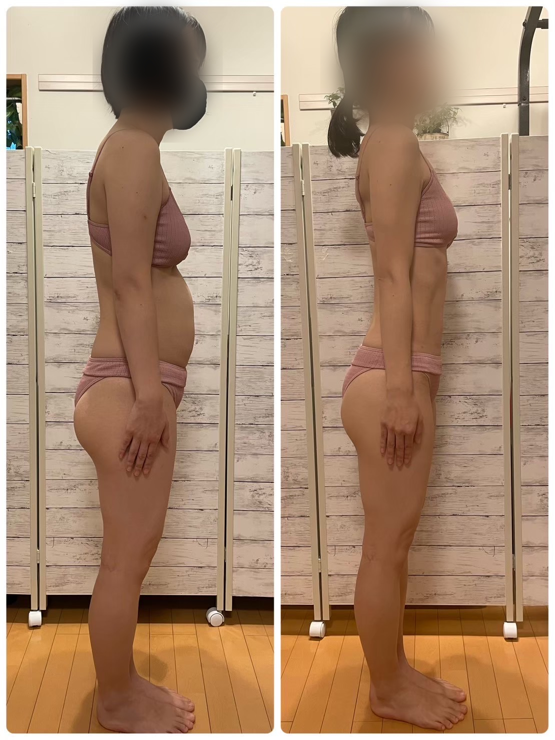 30代女性|6か月、−10kgの横向きBefore/After